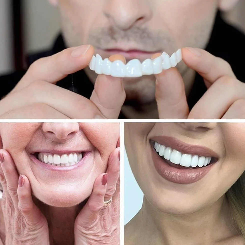 Protesi Dentarie Temporanee a Clip per Denti Mancanti Storti Macchiati