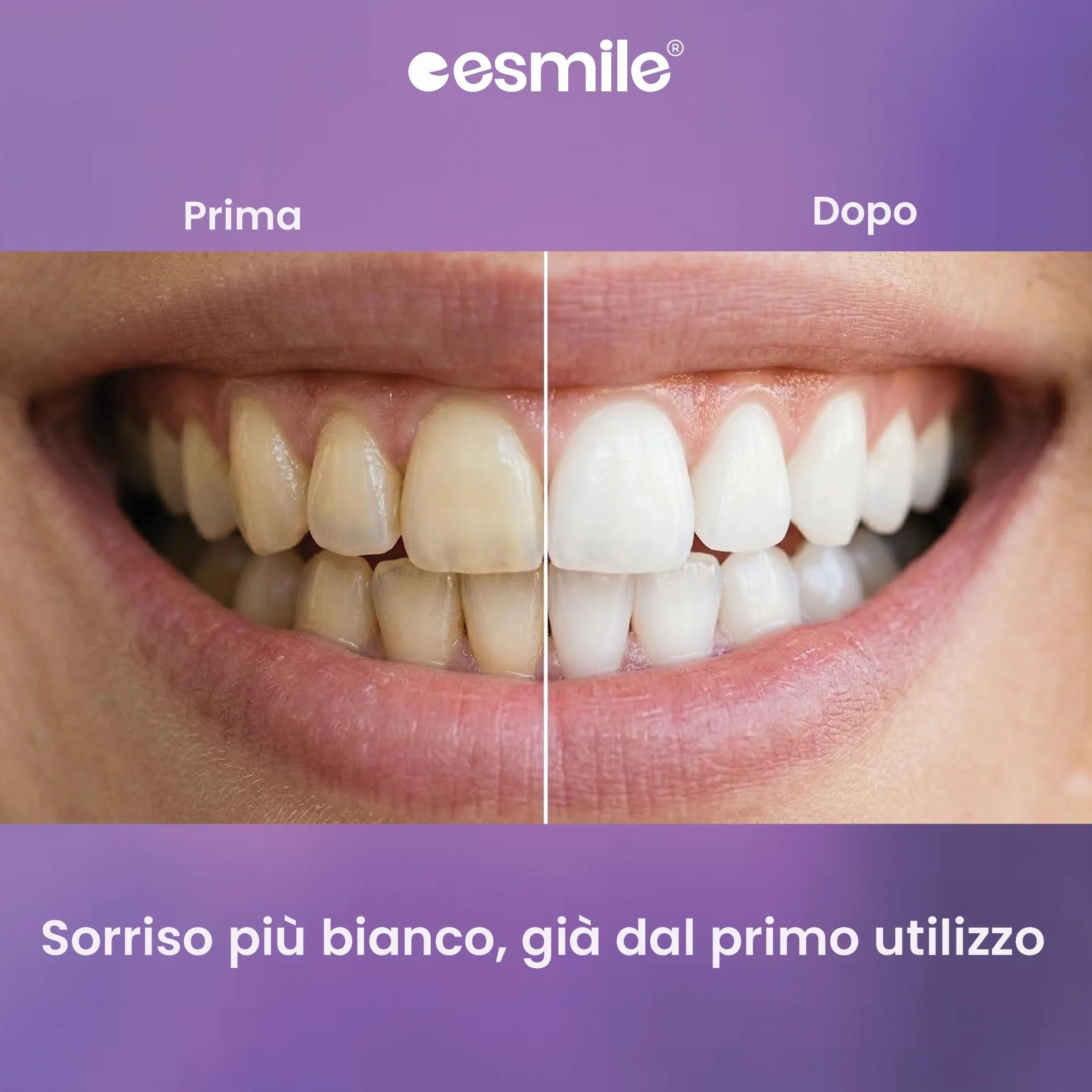ESMILE Polvere Sbiancante Denti Immediato Carbone Attivo Naturale Menta Sbiancamento Professionale Pasta Denti Bianchi 30 gr