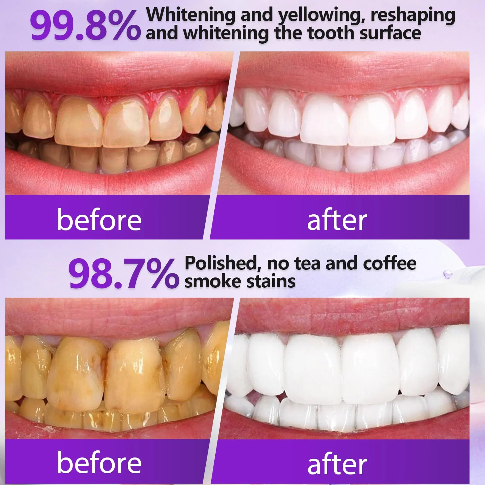 Polvere Sbiancante per Denti 50g, Immediato, Rimozione Macchie Profonde (viola)