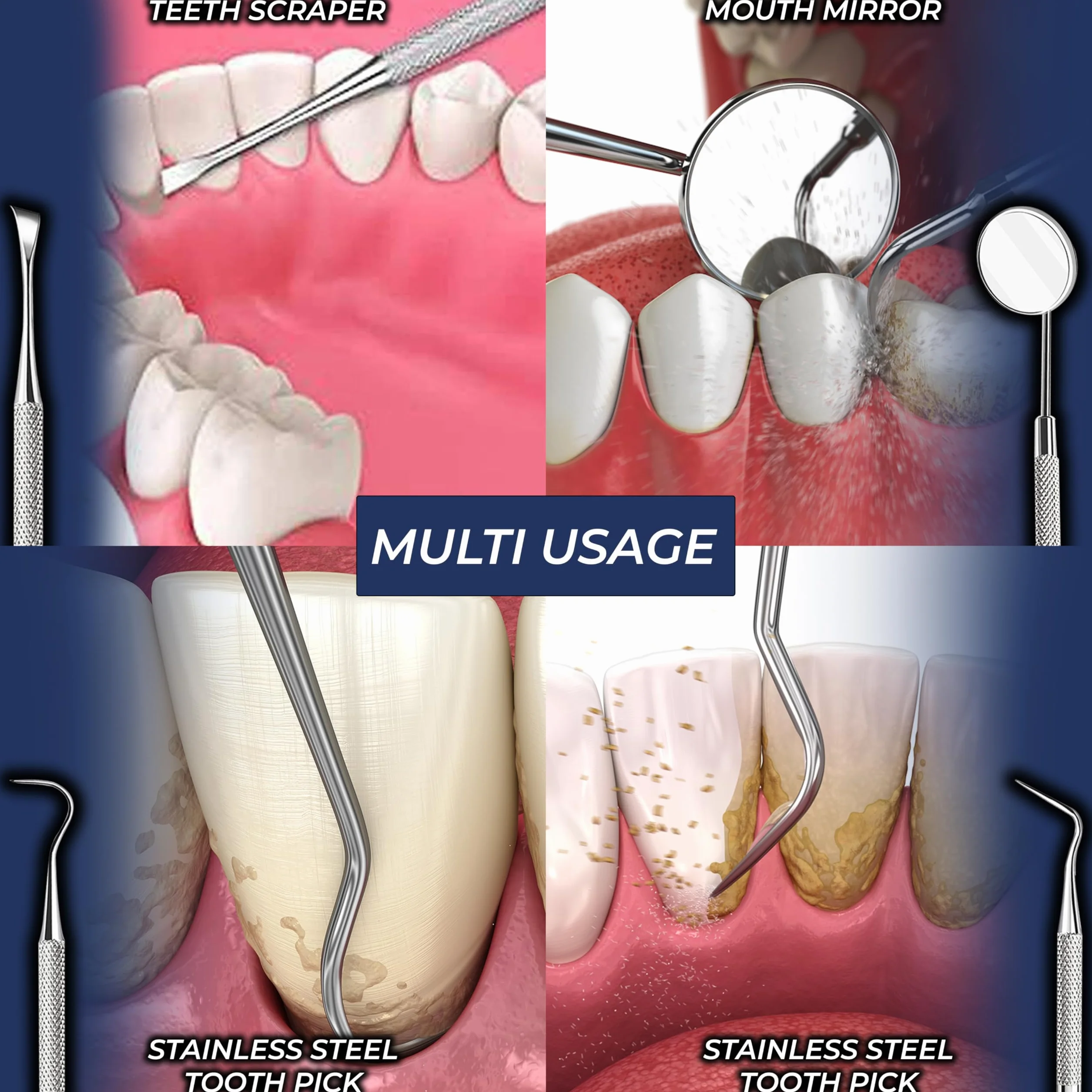 Set da 4 Strumenti per Pulizia Denti in Acciaio Inossidabile - Igiene Dentale e Rimozione Placca