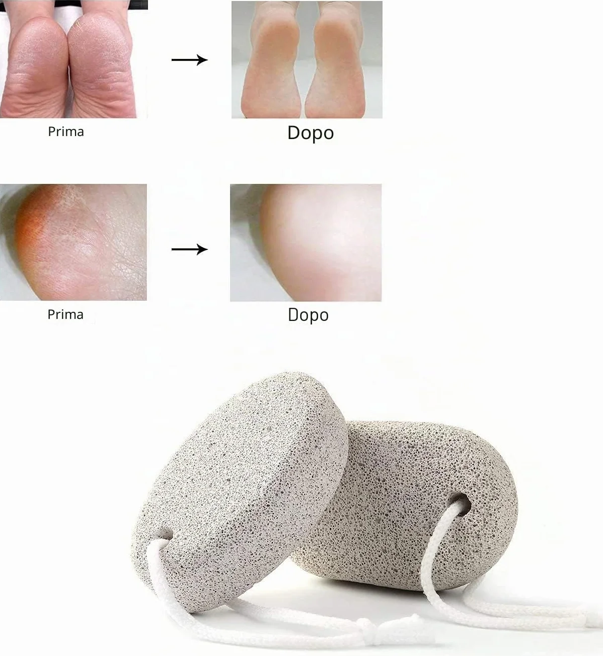 PHOGARY Pietra pomice naturale per piedi 2 pezzi strumenti pedicure rimozione calli pelle dura esfoliazione