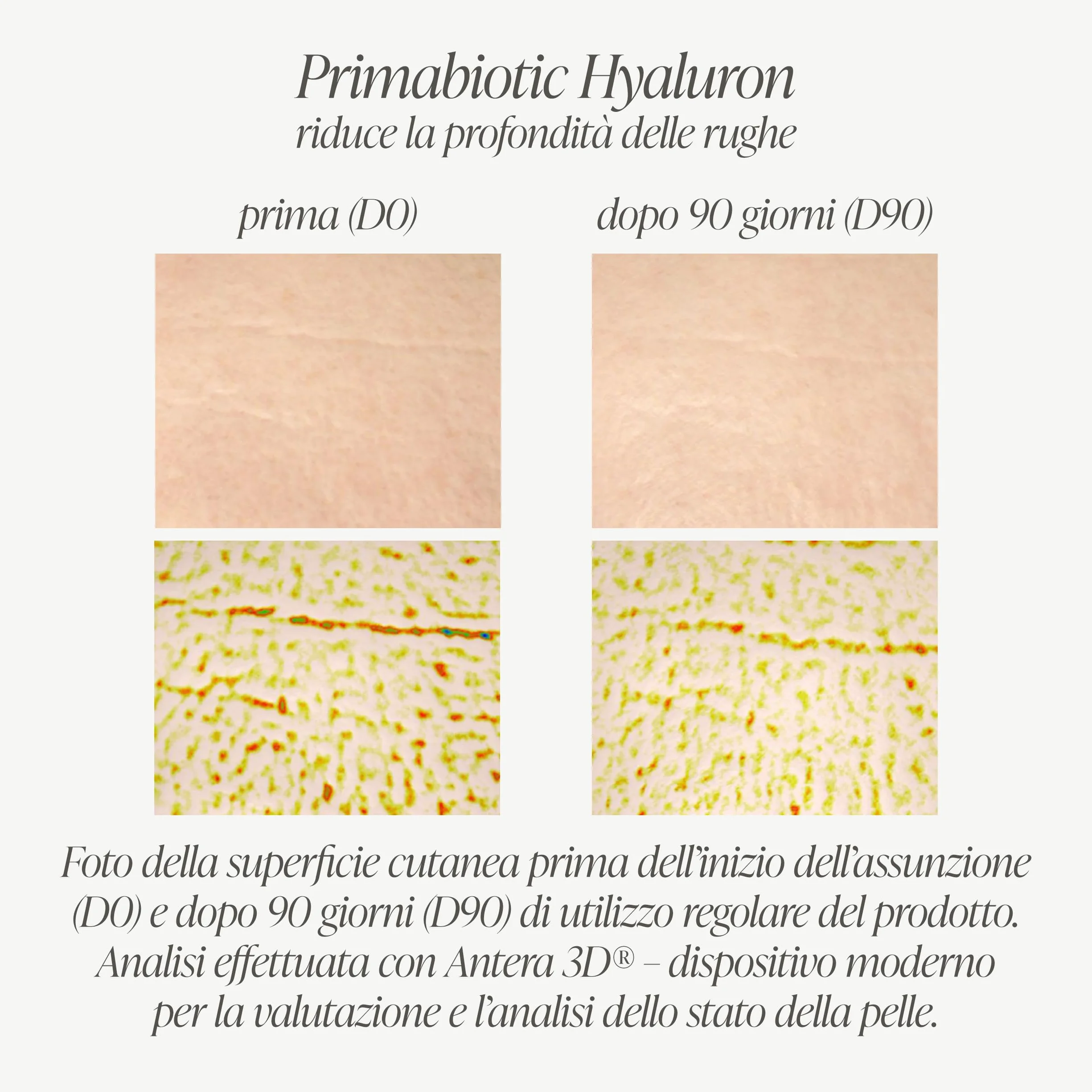 Primabiotic Acido Ialuronico da Bere 250 mg 30 Flaconcini 30 ml Integratore Liquido per Pelle Viso Vegano Senza Glutine