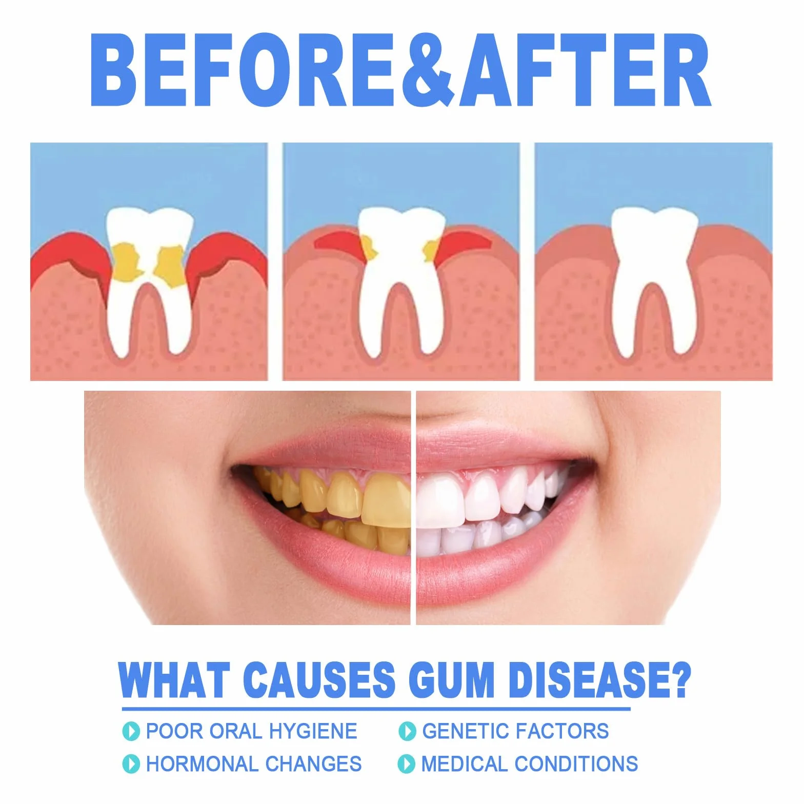 Gum Protect Repair Gel terapeutico per le gengive