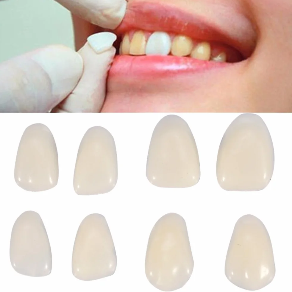 70PCS Veneer Dentali Naturale Resina Fronte Superiore Corona Temporanea Non Tossico