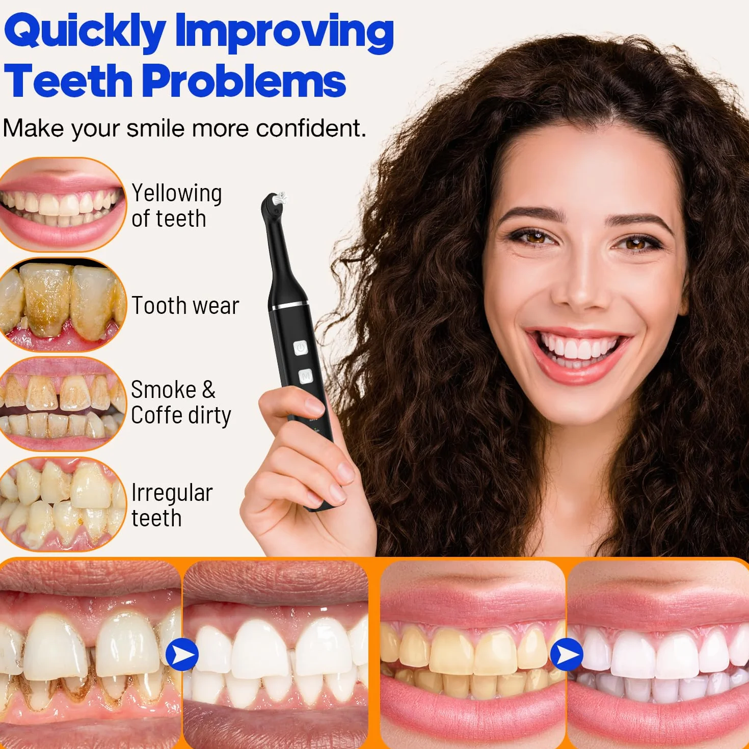 RRZIOM Kit Pulizia Denti Professionale, Macchine Per La Lucidatura Dentale, Impermeabile con Luce LED, 5 Testine, 5 Modalità, Ricaricabile