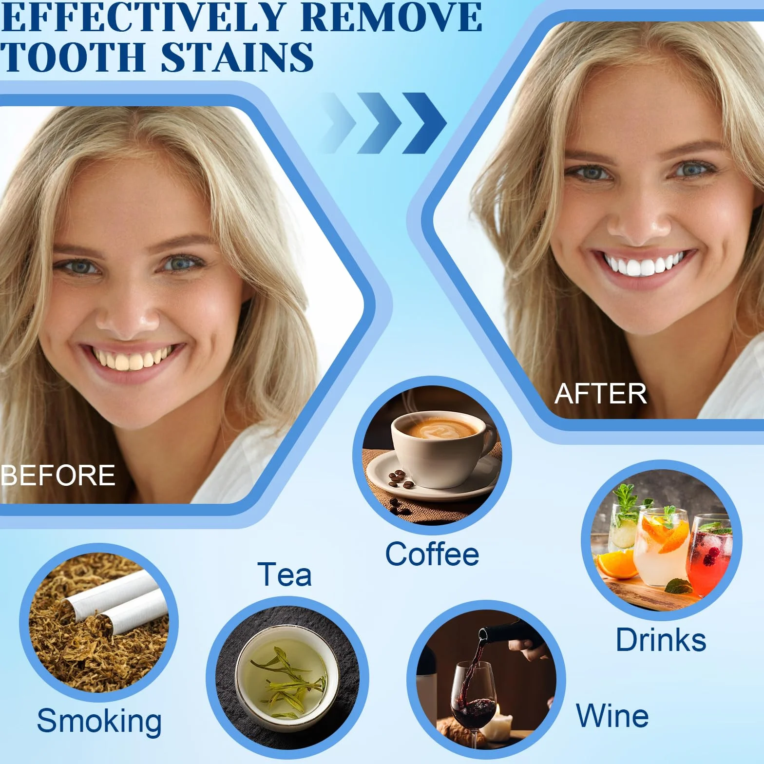 Penna Sbiancante Denti Professionale 2 Pezzi, Gel Sbiancante Rimuove Macchie Dentali