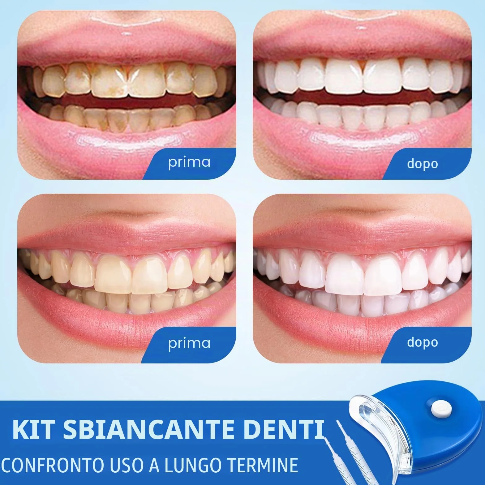 Kit Sbiancante Denti Professionale 5 Gel Sbiancante per Ridurre Macchie da Caffè Tè e Fumo Blu