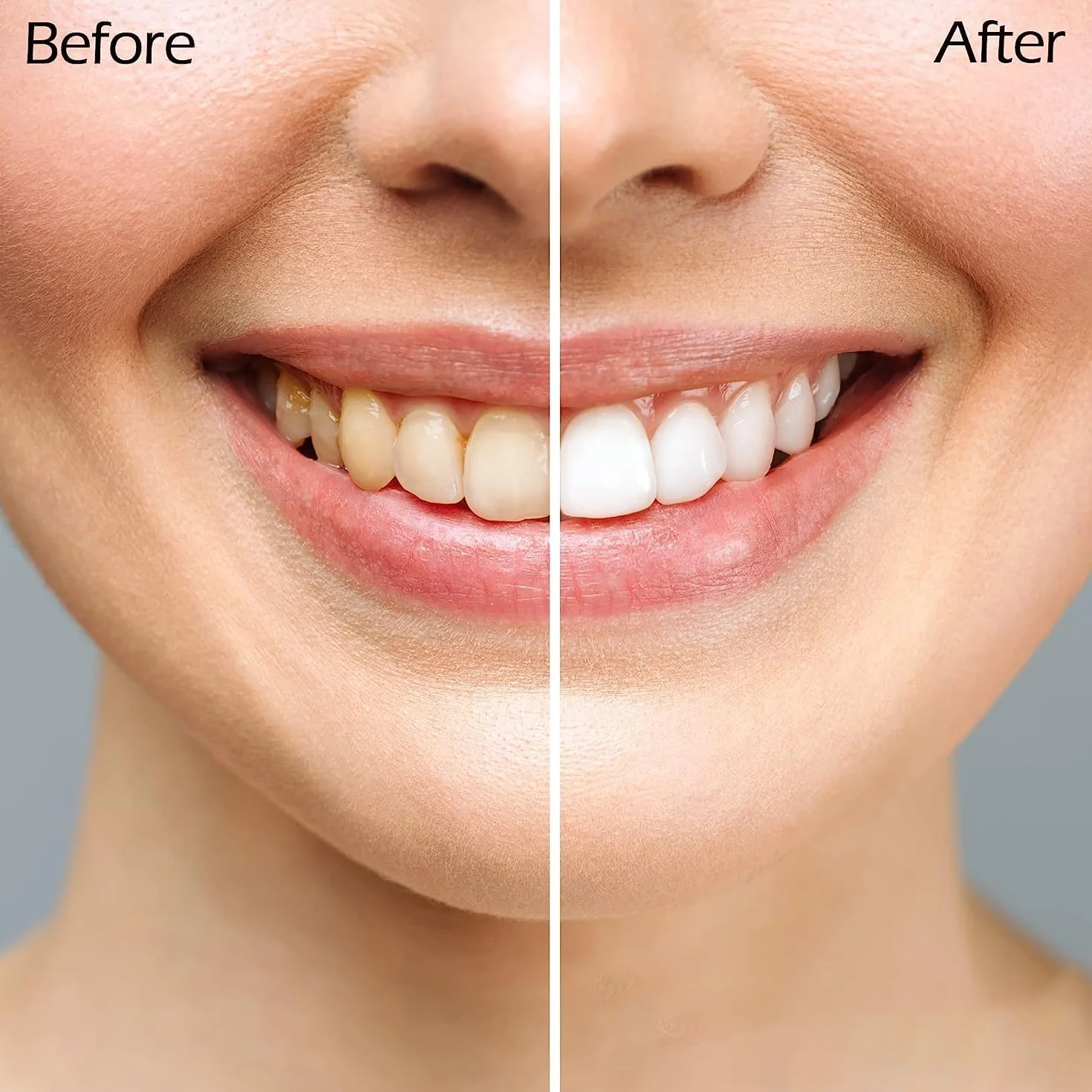 Sbiancante Denti Strisce Sbiancanti 28 Strisce 14 Sessioni Sbiancamento Denti