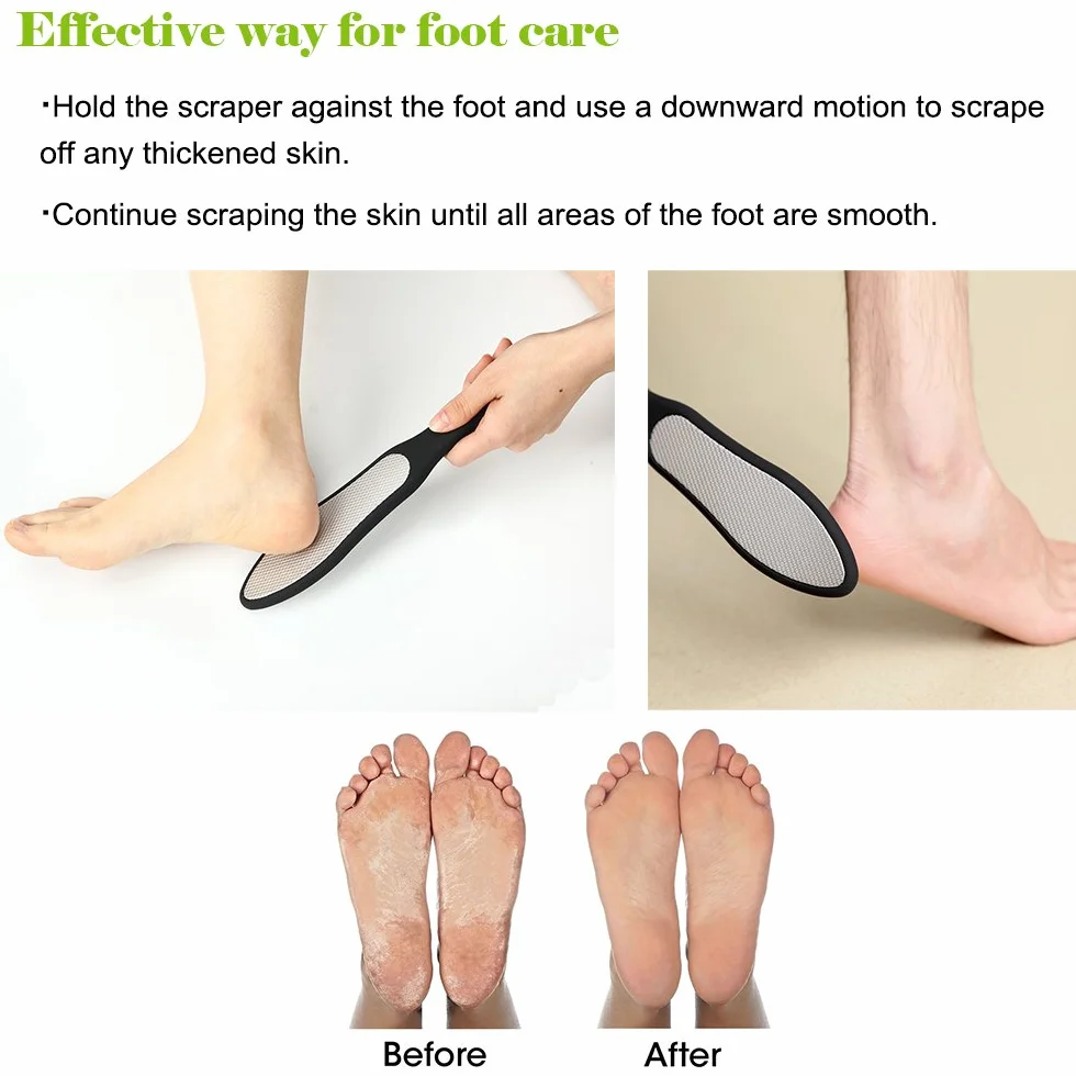 BEZOX Lima Per Piedi Professionale - Calli Remover Pedicure Acciaio Inox