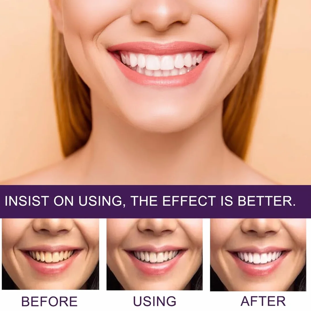 Sbiancante Denti Strisce Sbiancanti 28 Pezzi 14 Sessioni Sbiancamento Denti Whitening Strips