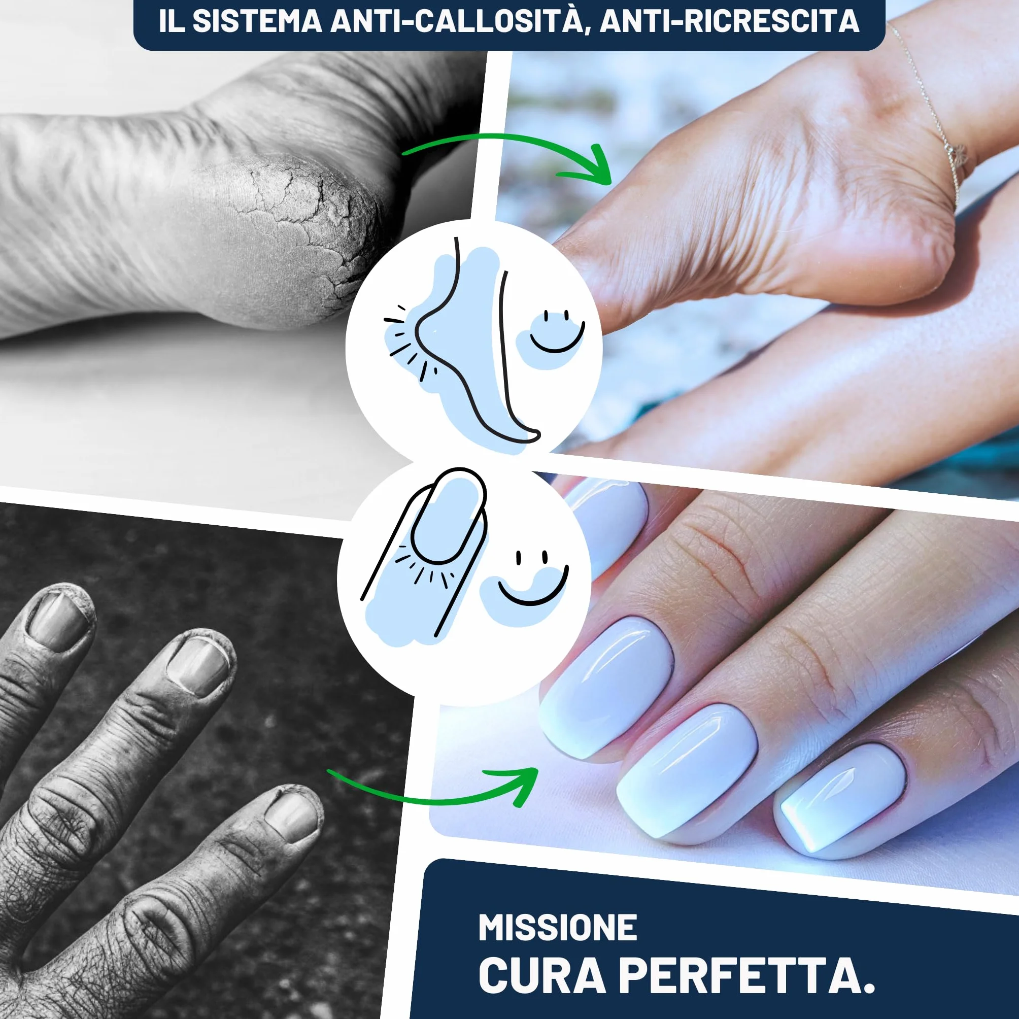 Mr. Fuss Soluzione Cheratolitica Intensiva per Rimozione Calli - Lozione Ammorbidente Rapida 250ml No. 4 Plus Pack Set Pedicure