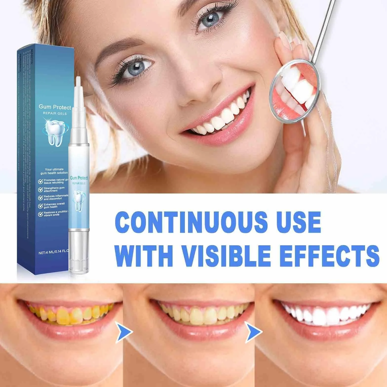 Gel per la terapia delle gengive Gum Protect e Repair Cura intensiva rigenerazione trattamento parodontale
