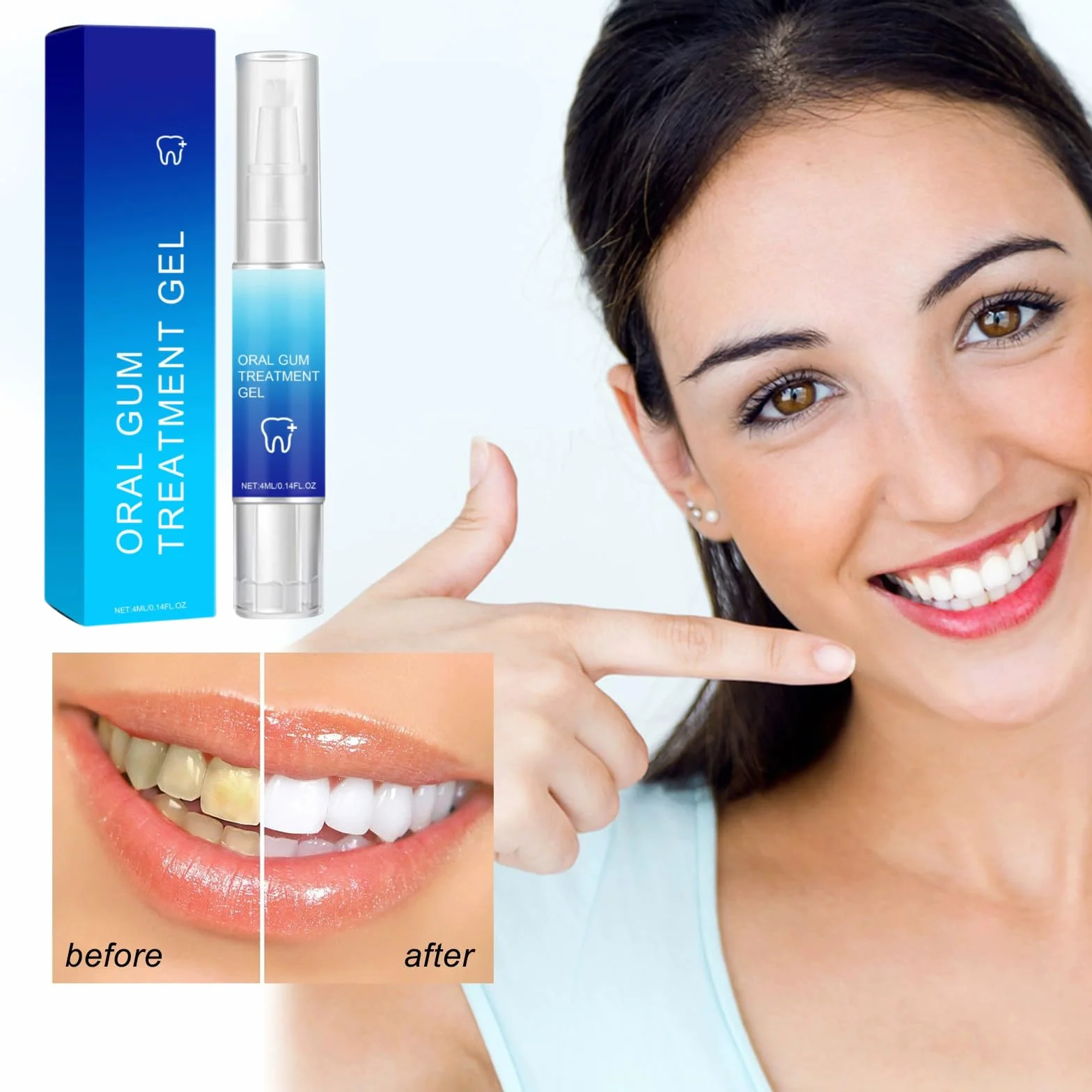 Cureend Teeth Repair Gel Per Riparare Le Gengive Ritirate, Gum Shield Therapy Gel 4 Pezzi