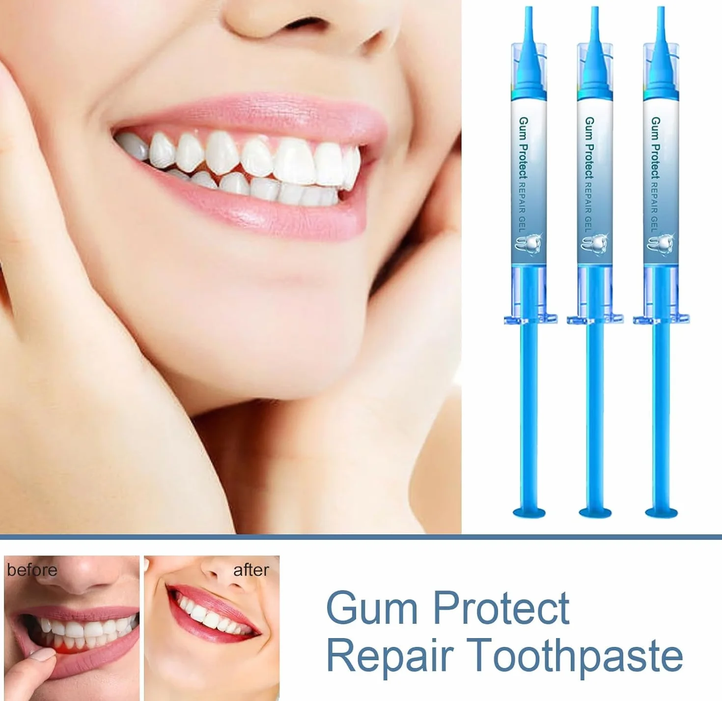 Gel Topico Rigenerazione Tessuti Orali Crescita Gengiva Protezione Salute Gengive 6pc