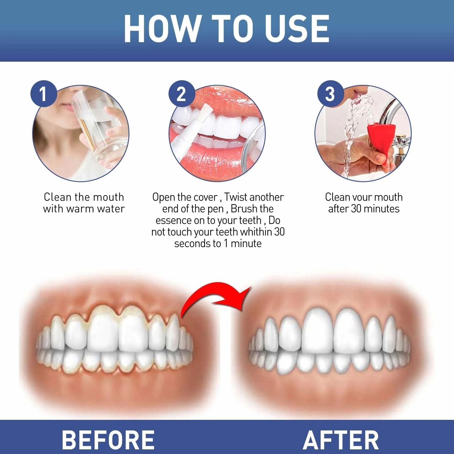 DentiZen Gum Therapy Gel - Terapia naturale delle gengive, ripristino gengive, per denti sensibili