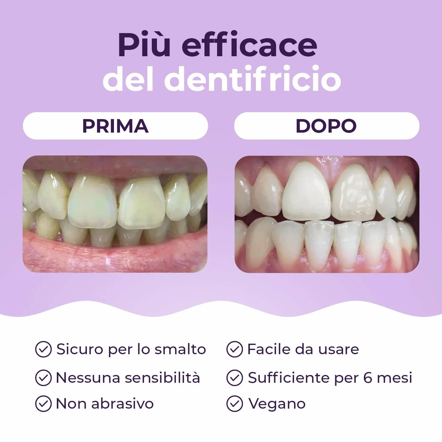Onlysmile Polvere sbiancante per denti professionale – sicuro, indolore, effetto pulente