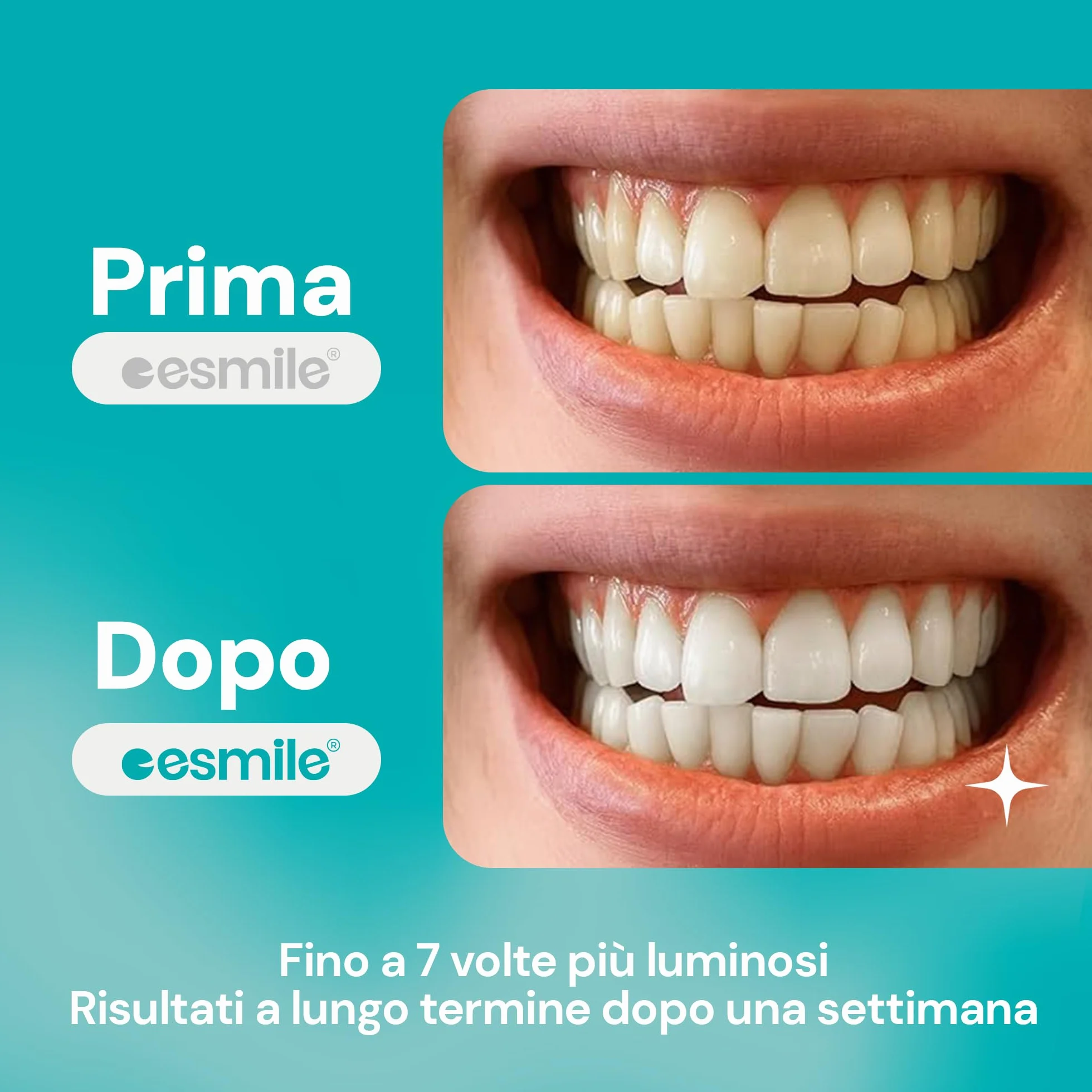ESMILE Strisce Sbiancanti Denti, Trattamento Professionale a Casa, 14 Strisce