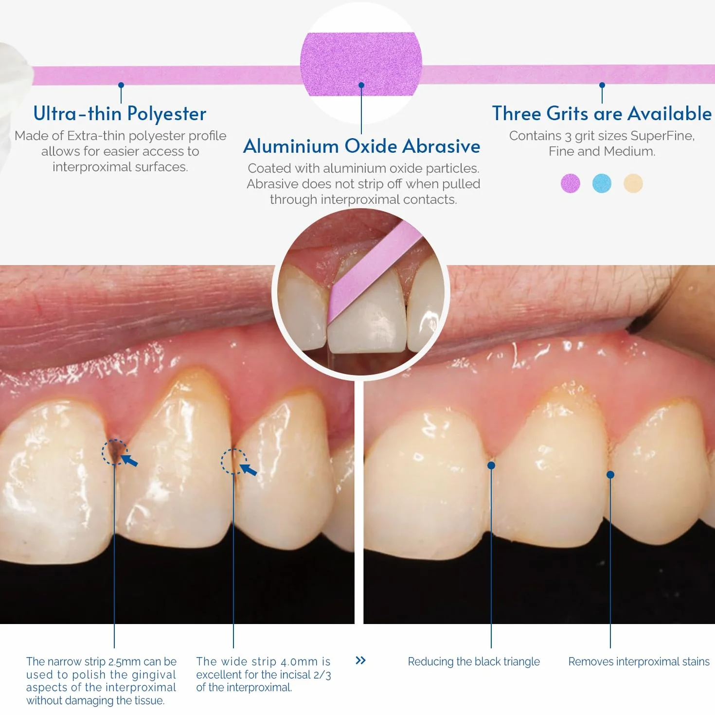 NatureAqua Resin Carta Vetrata per Denti Strisce Lucidatura Dentale Grana 50μm Larghezza 4mm 6M Rotolo