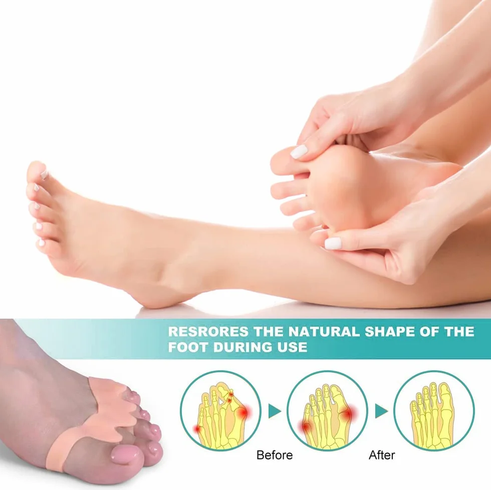 Separatore Dita Piede 4 Pezzi Silicone Distanziatore Dita Piedi Toe Spacer per Alluce Valgo