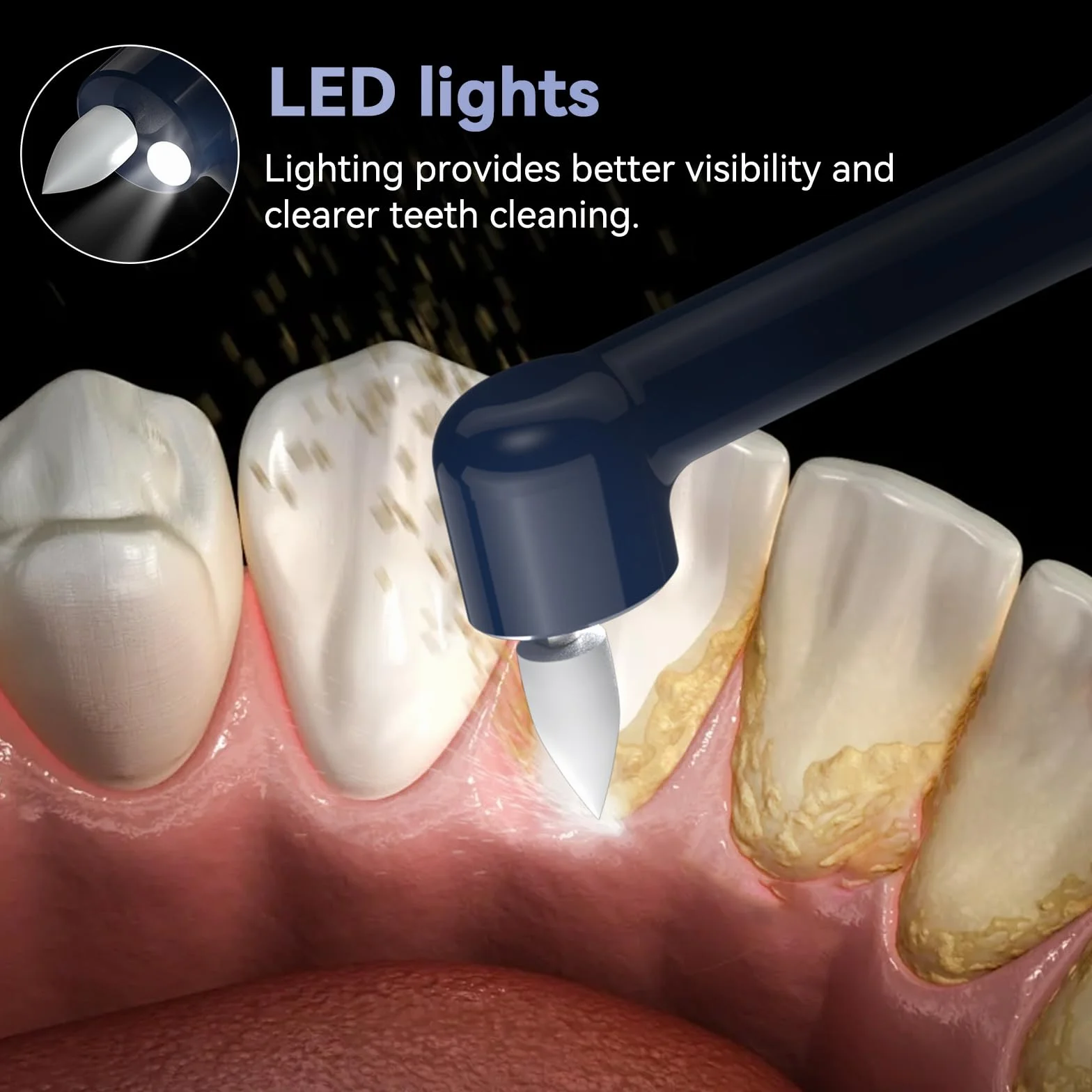 Beedove Accessorio per Lucidatura Dentale 6 Testine di Ricambio Multifunzionali