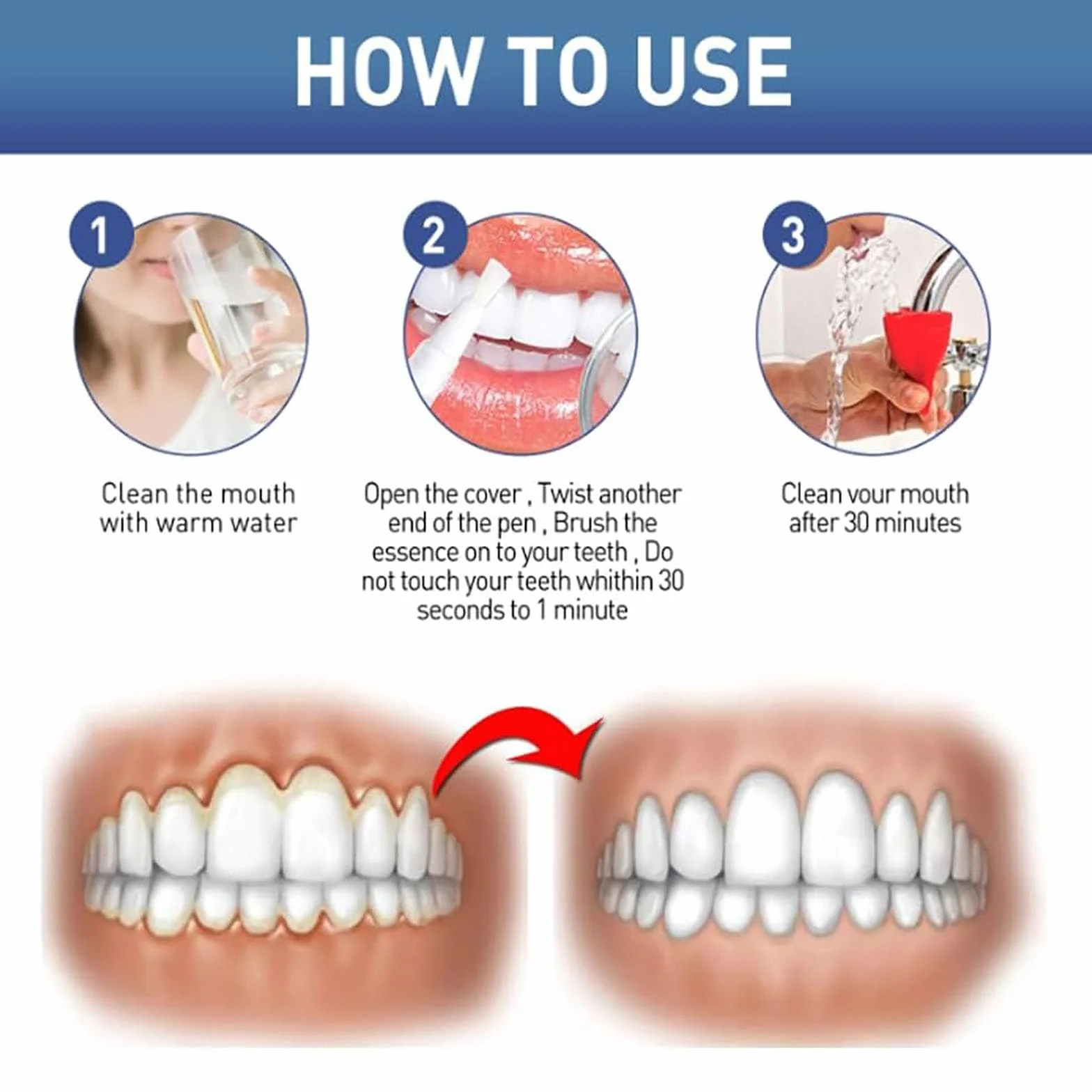 GumEase Gum Gel riparazione denti gengive lenitivo istantaneo penna essenza alito fresco igiene orale