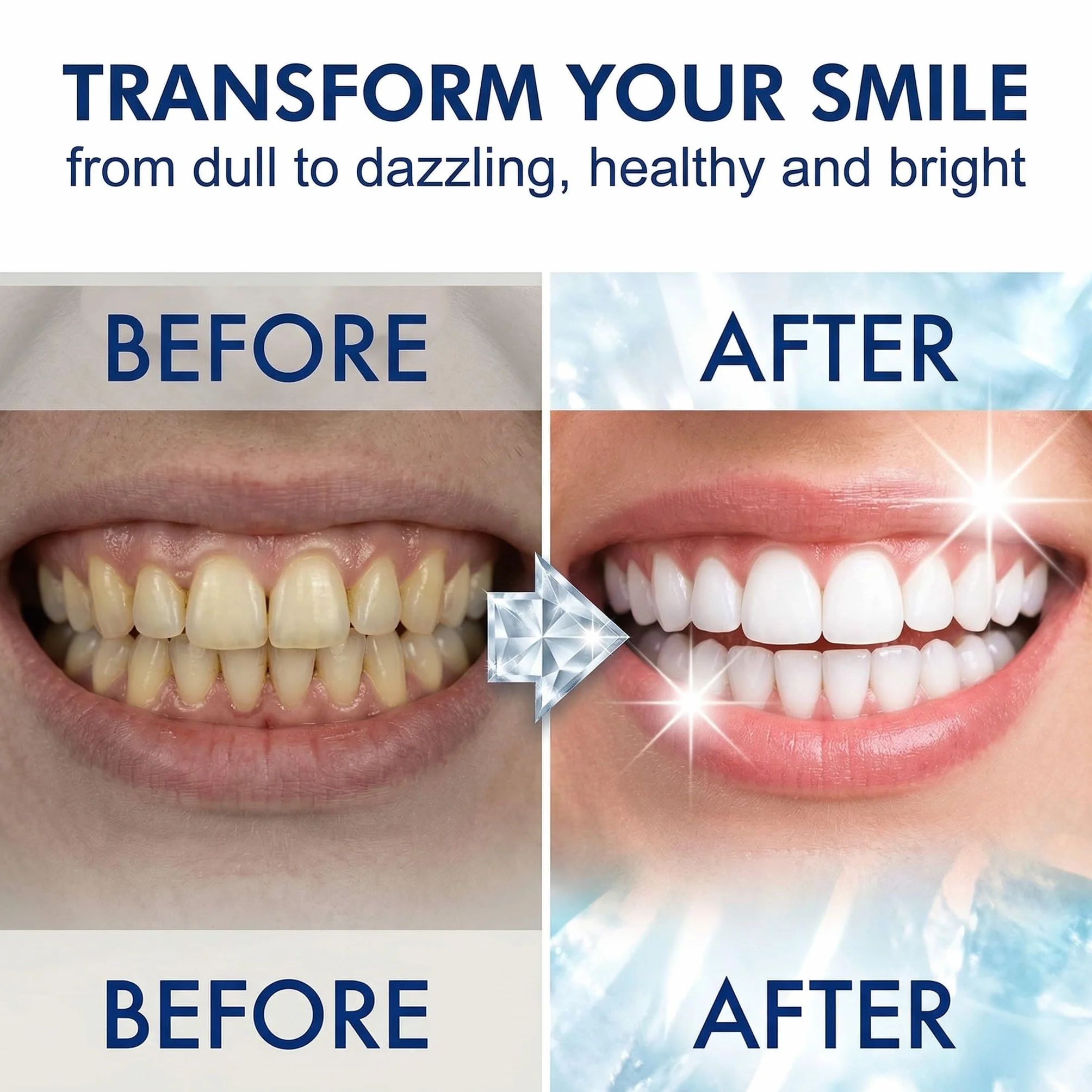 Gel Lenitivo per Gengive Trattamento Parodontale 3 Pezzi con Menta Piperita Sbiancamento Dentale