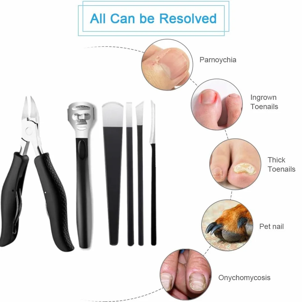 Kit di Coltelli da Pedicure in Acciaio Inossidabile per Rimozione Calli