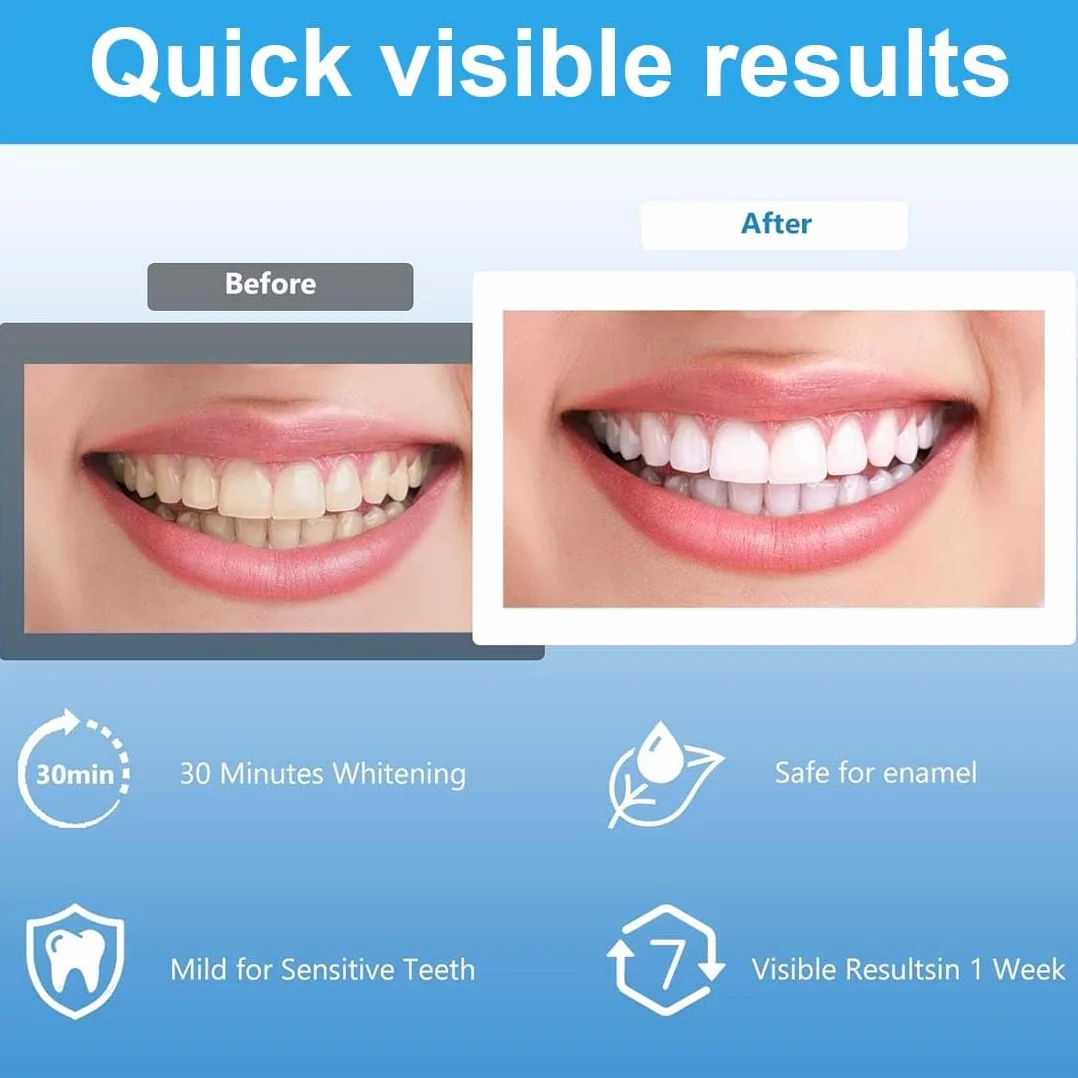Teeth Whitening Strips 28 Strisce Sbiancanti Denti, Kit Sbiancante Denti Carbone di Bambù