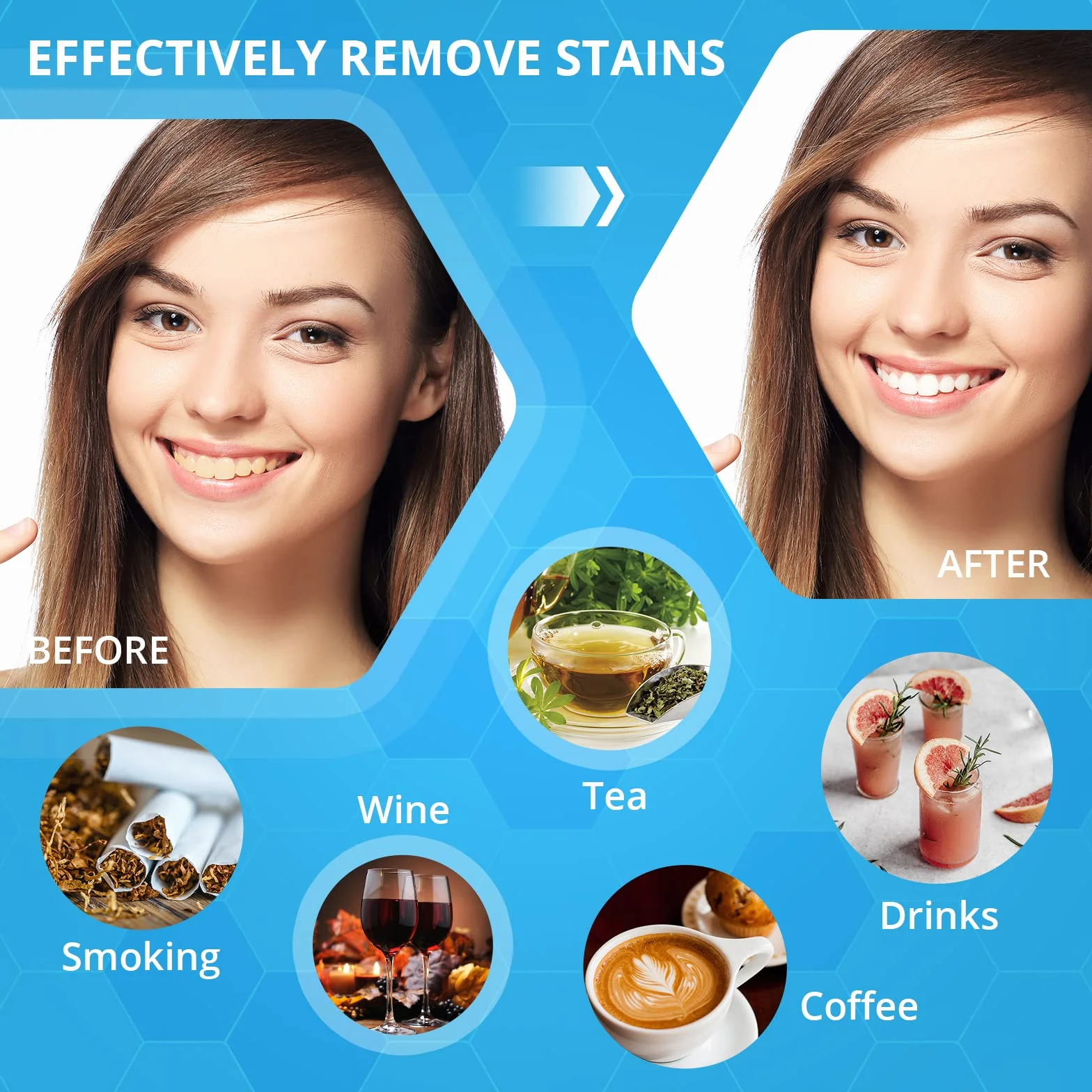 Bledras Kit Sbiancante per Denti Professionale 12 Gel 3 Lenitivi