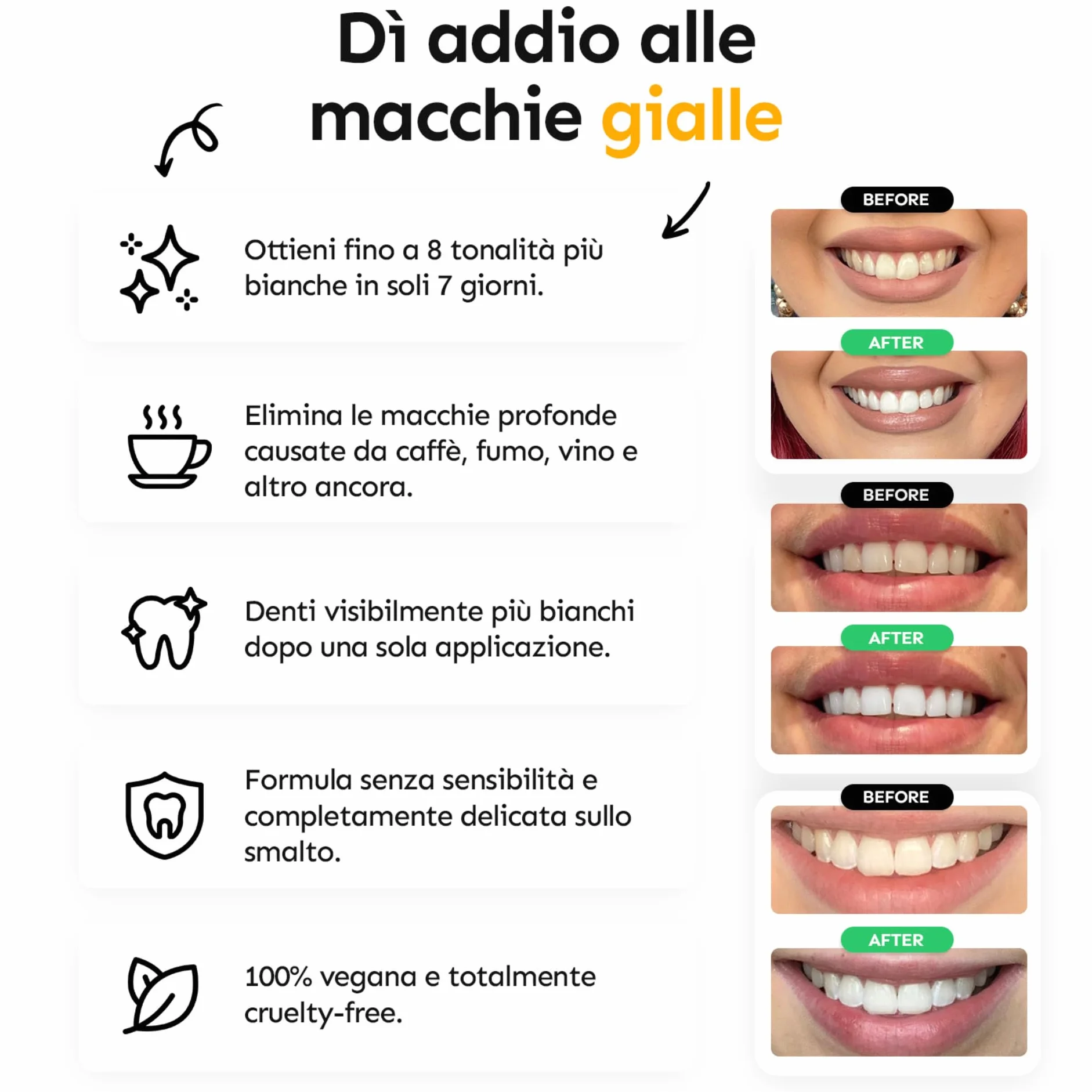 Whites Beaconsfield Strisce Sbiancanti per Denti, 28 Strisce (14 Giorni) – Senza Perossido, Sicura per Smalto, Sbiancamento Rapido