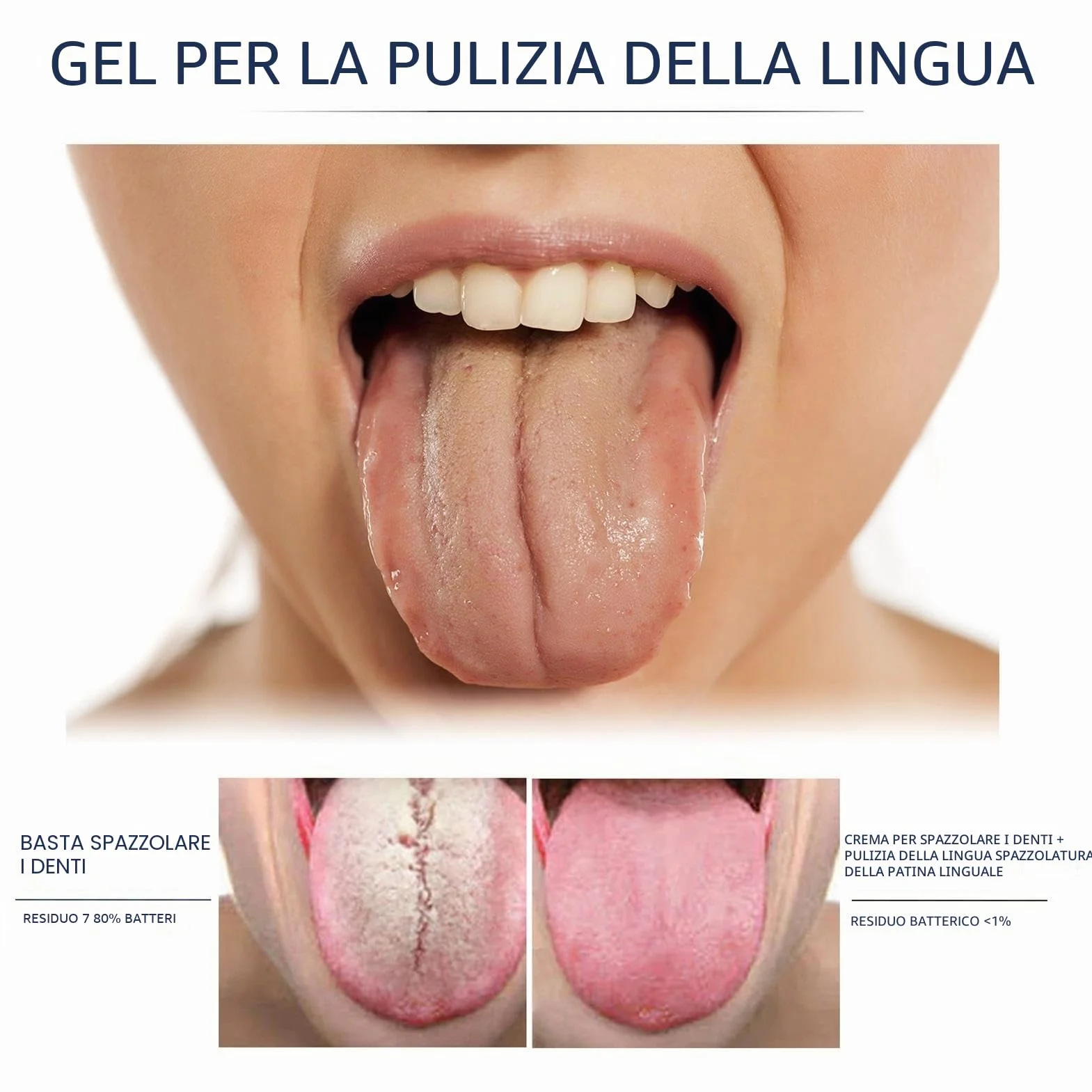 Gel per la pulizia della lingua con pennello, trattamento mughetto bocca, rimuove odore orale