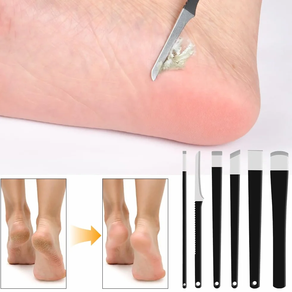 LOPHE Set Pedicure Professionale Acciaio Inox 6 Pezzi Kit Coltelli con Custodia Rimuovere Calli Pelle Morta