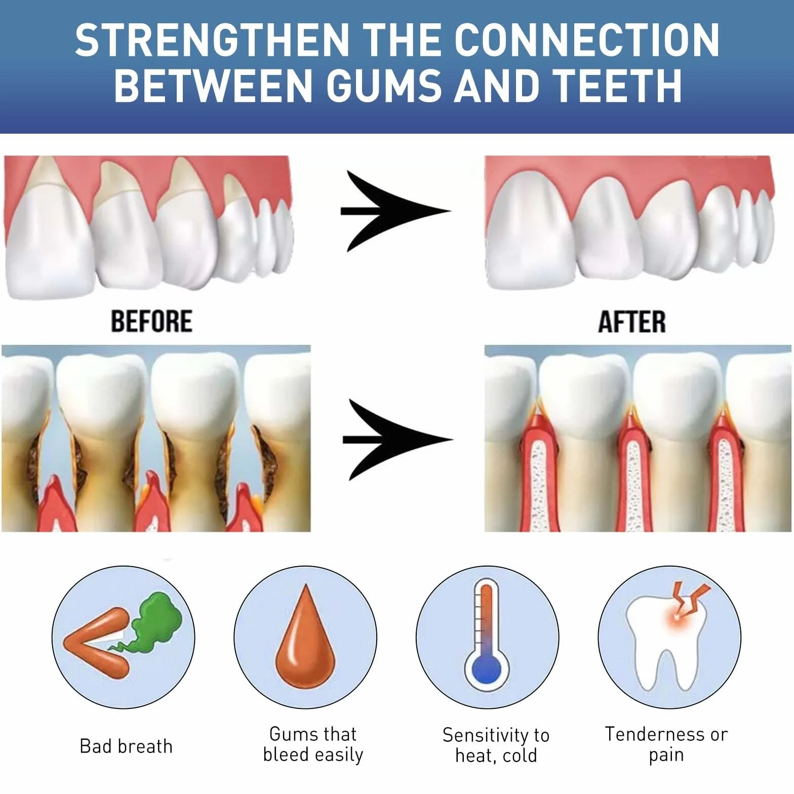 DentiZen Gum Therapy Gel - Terapia naturale delle gengive, ripristino gengive, per denti sensibili