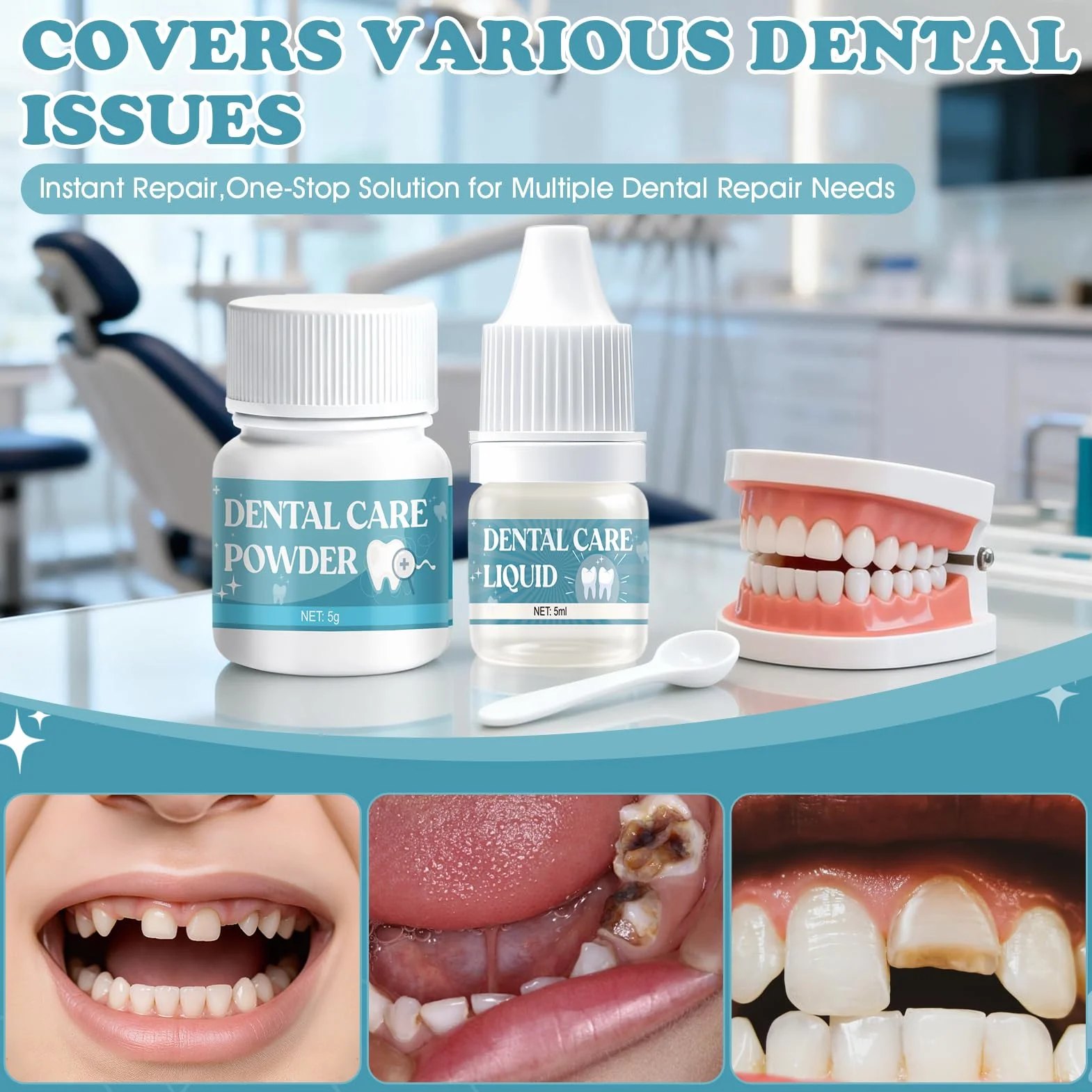 Cemento Dentale Definitivo per Ponti, Capsule e Denti a Perno