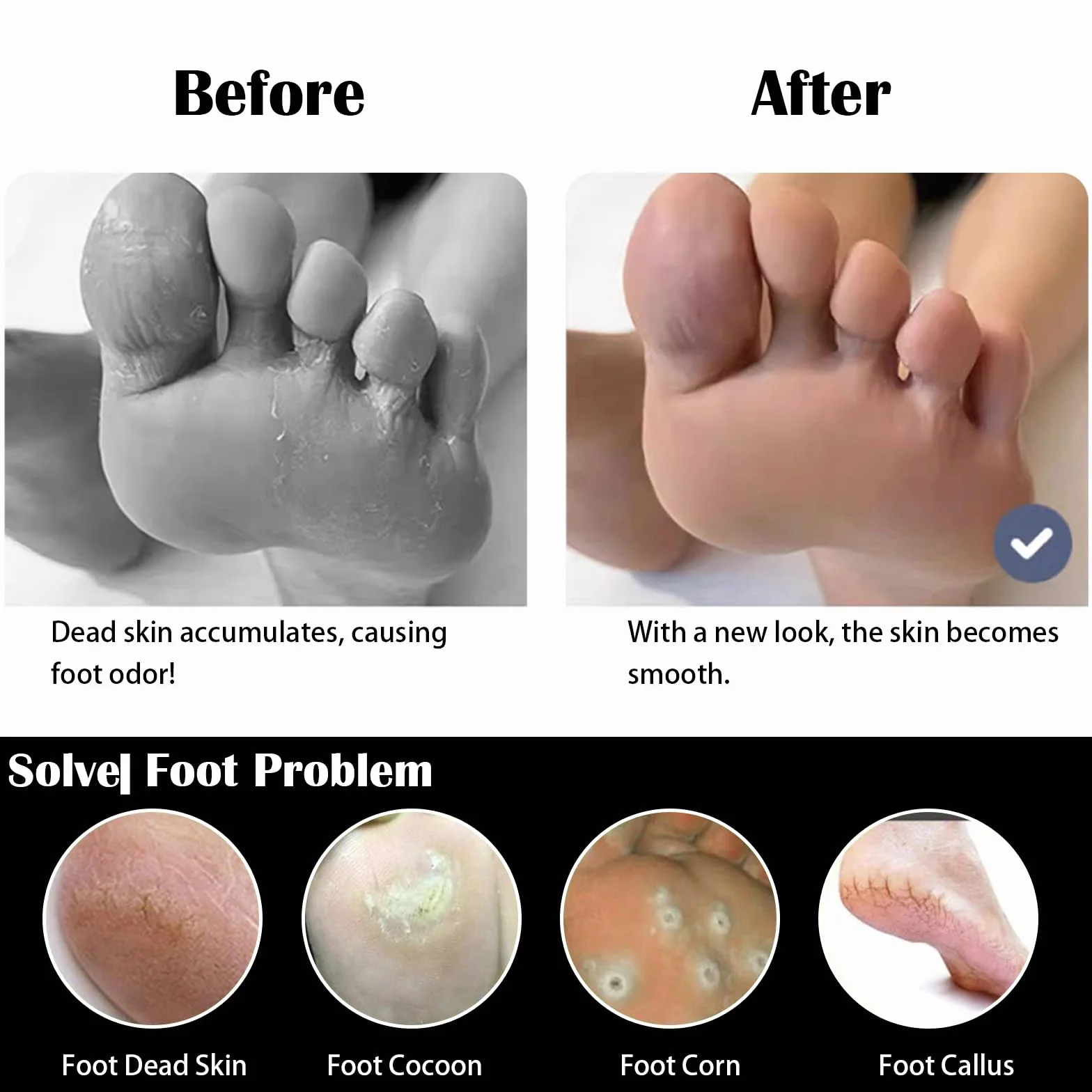 Kit Pedicure Professionale per Rimuovere la Pelle Morta, Cura dei Piedi