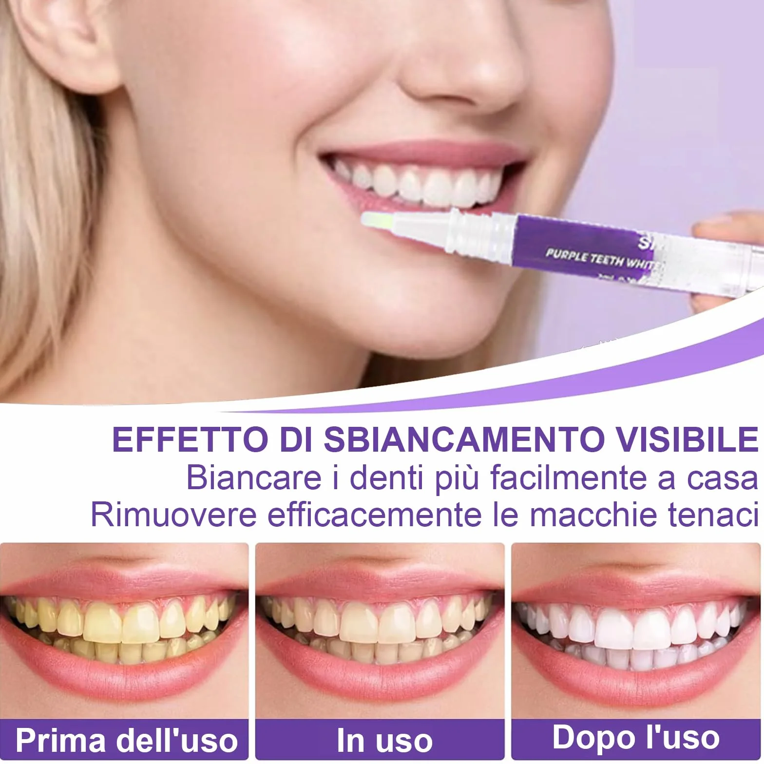 Kit Sbiancante Denti Professionale, Gel Sbiancamento Dentale, Rimuove Macchie Caffè, Viola 3 Pezzi