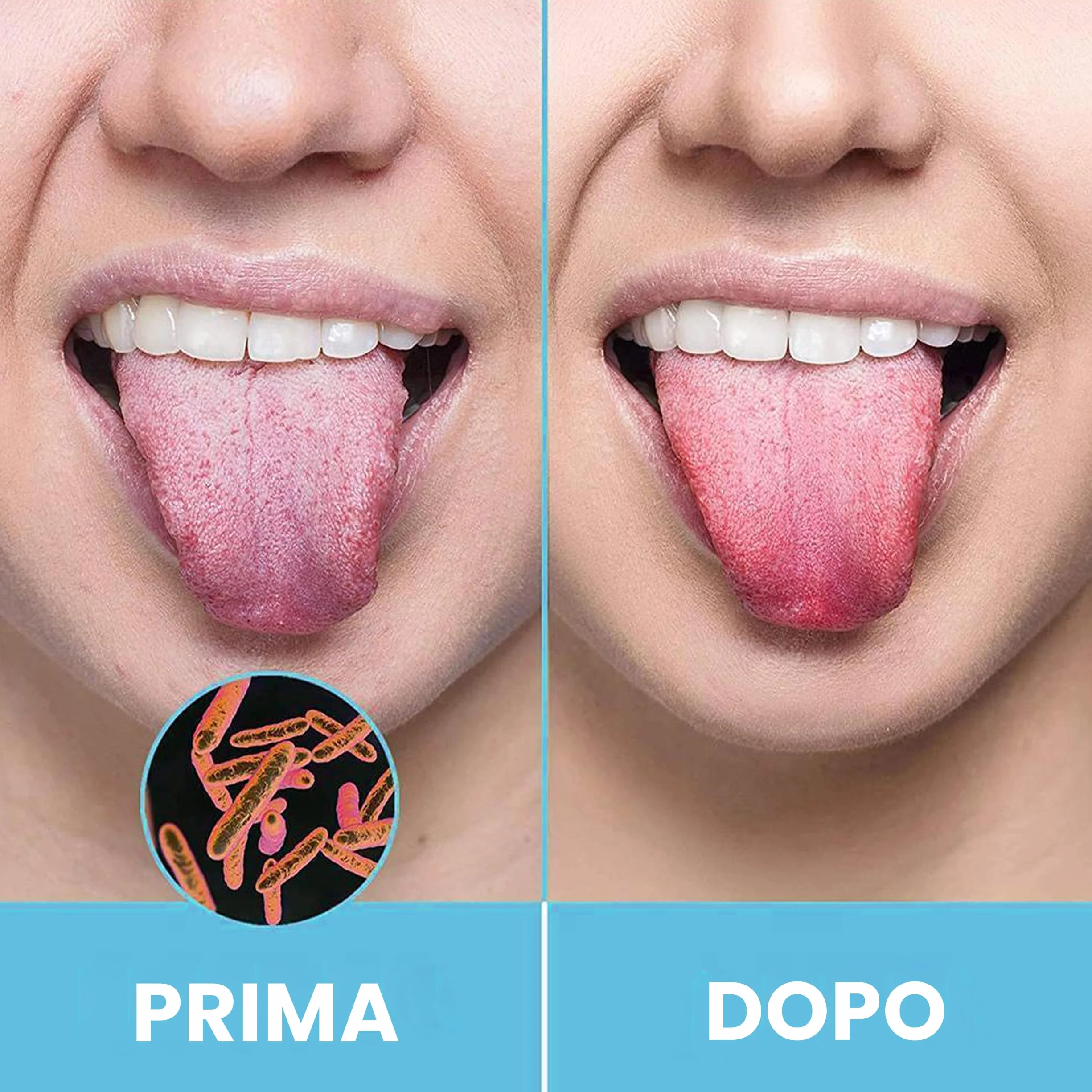 HOKIN Raschietto Lingua in Acciaio Antimacchia per Adulti Combatti Alito Cattivo Tongue Scraper Cleaner Nettalingua