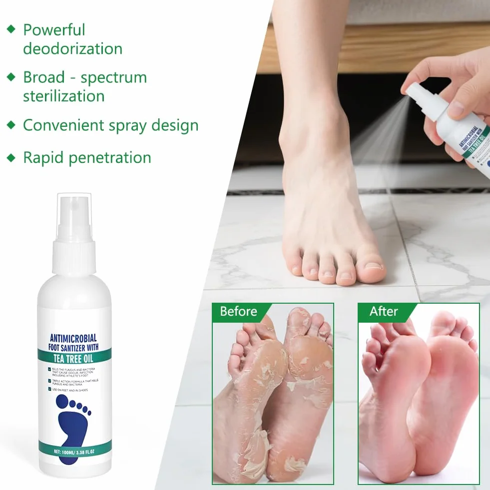 AOOWU Spray Antifungino del Piede, 100ml Trattamento Piede d'Atleta ad Azione Rapida