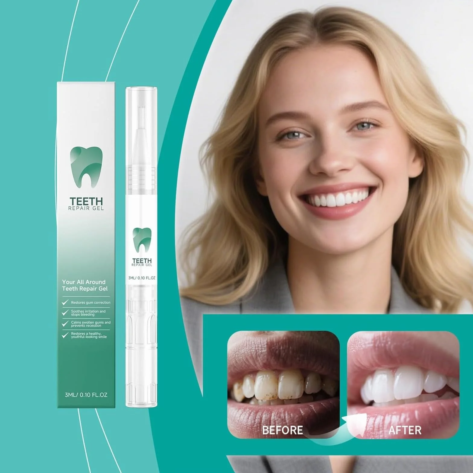 Gel riparazione denti, kit riparazione gengive, penna sbiancante denti, smacchiatore, protezione gengive