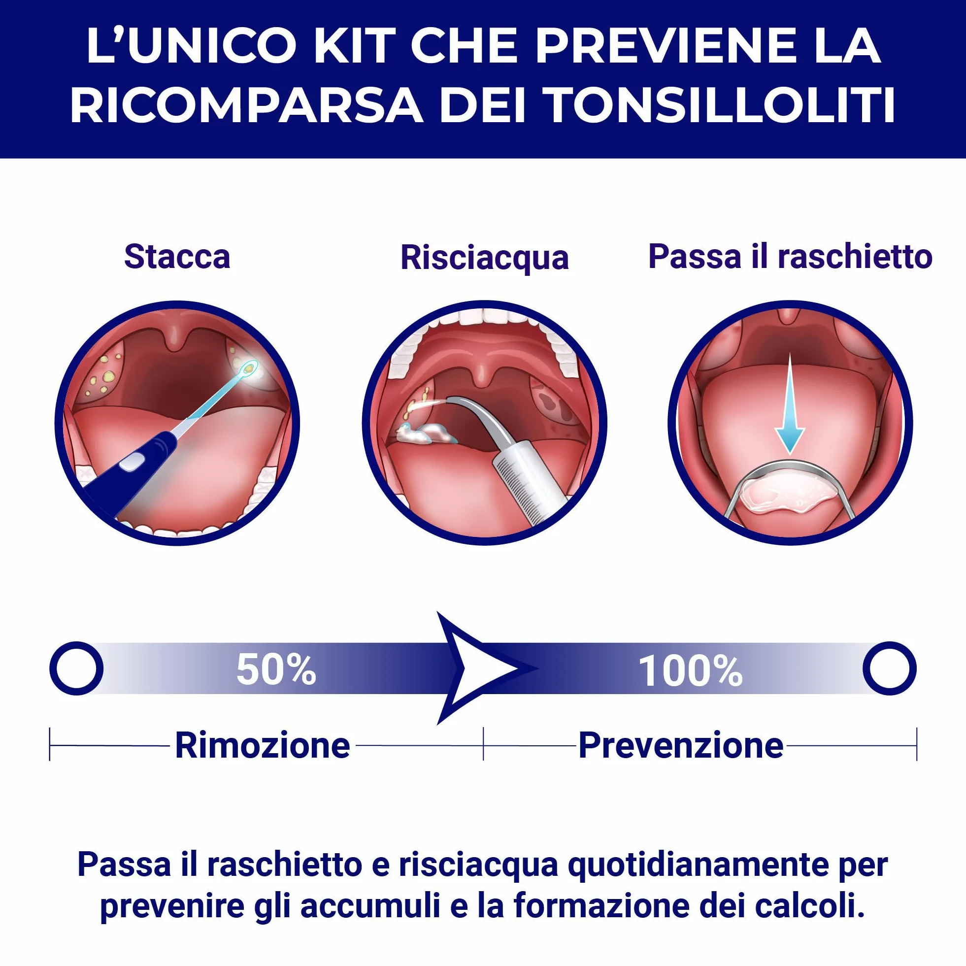 ORAVIX Kit per rimuovere calcoli tonsillari con luce LED, 3 beccucci, siringa e raschietto per lingua
